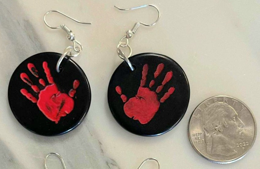 MMIW Acrylic Inlays